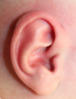 Ear Reshaping