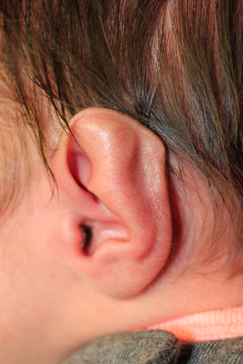 infant ear surgery