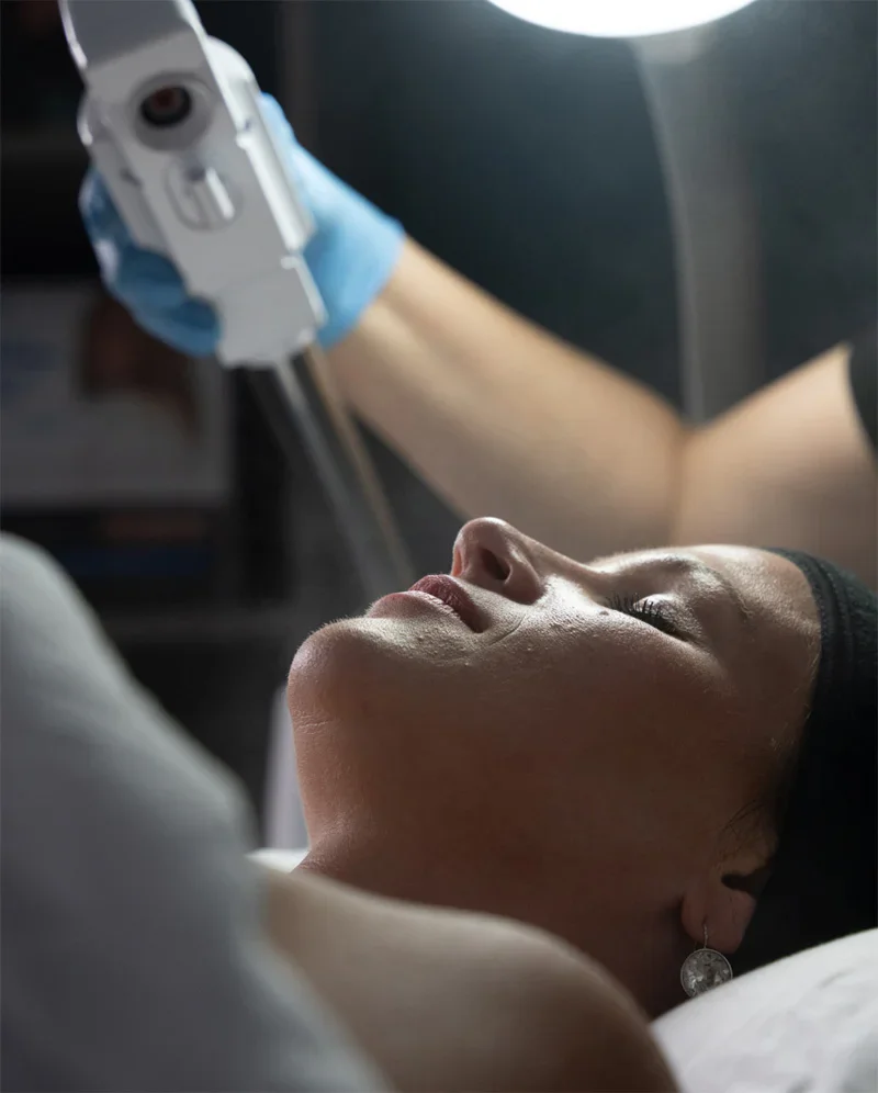 A close-up side-view shot of a patient lying down for a skin treatment. A gloved hand, holding a white device that is spraying a fine mist, is visible over the patient's face. The patient, a woman with a dark headband and a silver earring, is looking up, and her face is illuminated by a bright overhead treatment light. - Latelier Peels in Troy, MI