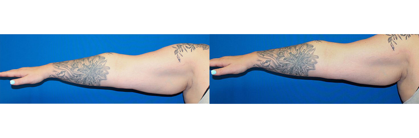 4505-nsskintight-p01-4