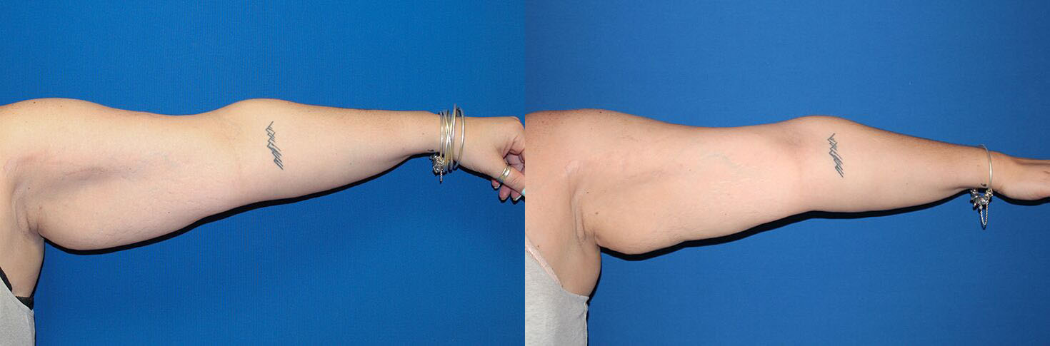 4506-nsskintight-p01-5