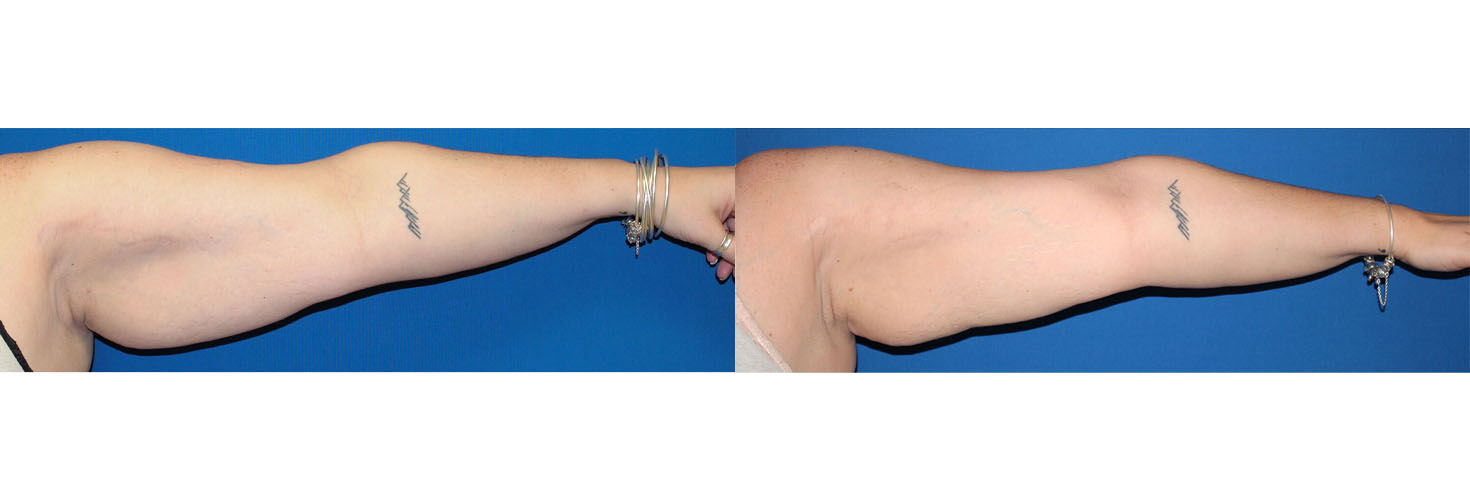 4507-nsskintight-p01-6