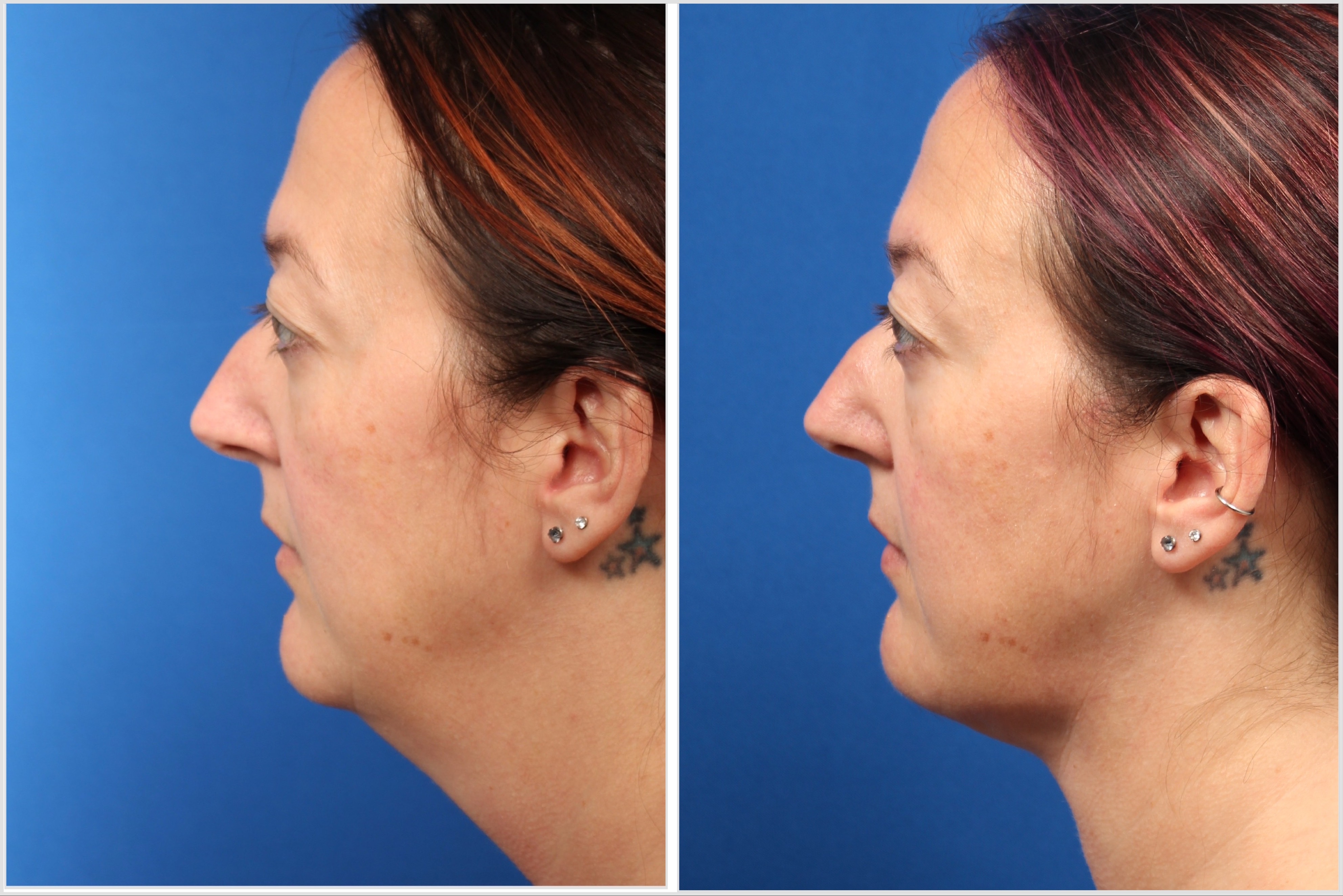 53335A83-E7A4-4A85-ADEE-780AEBCEC683