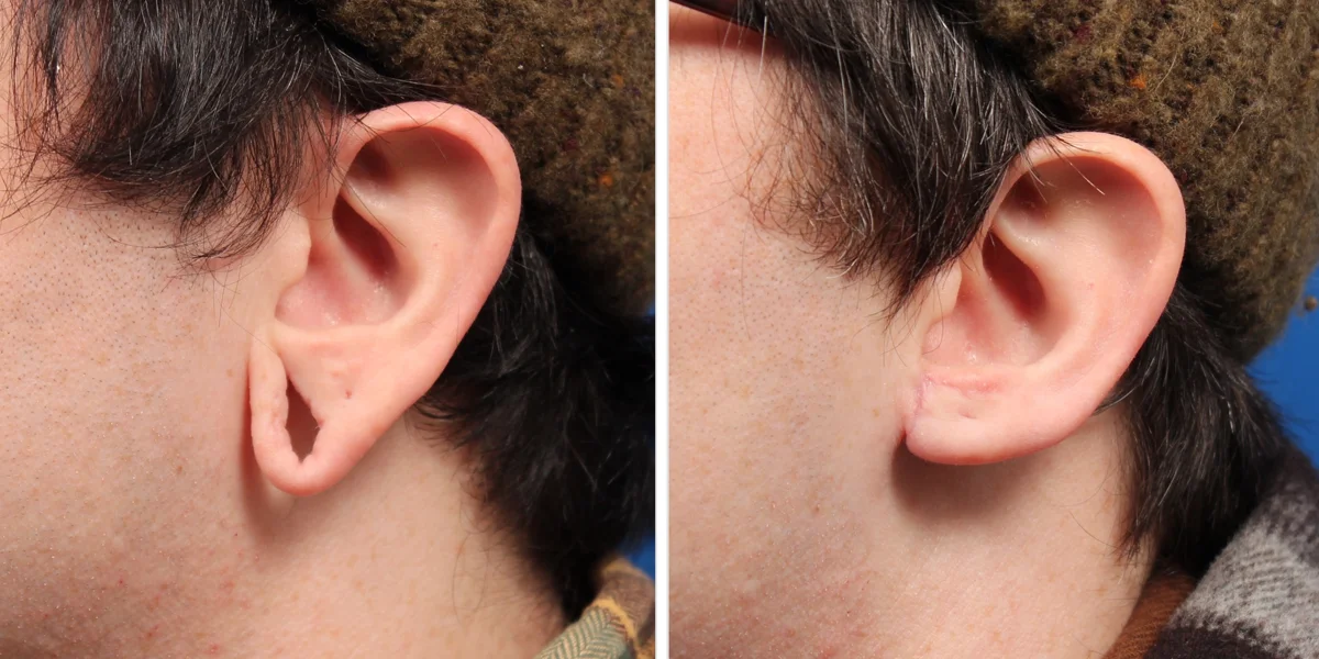 097E6626-2C3B-47D7-85E8-25FB9543D892