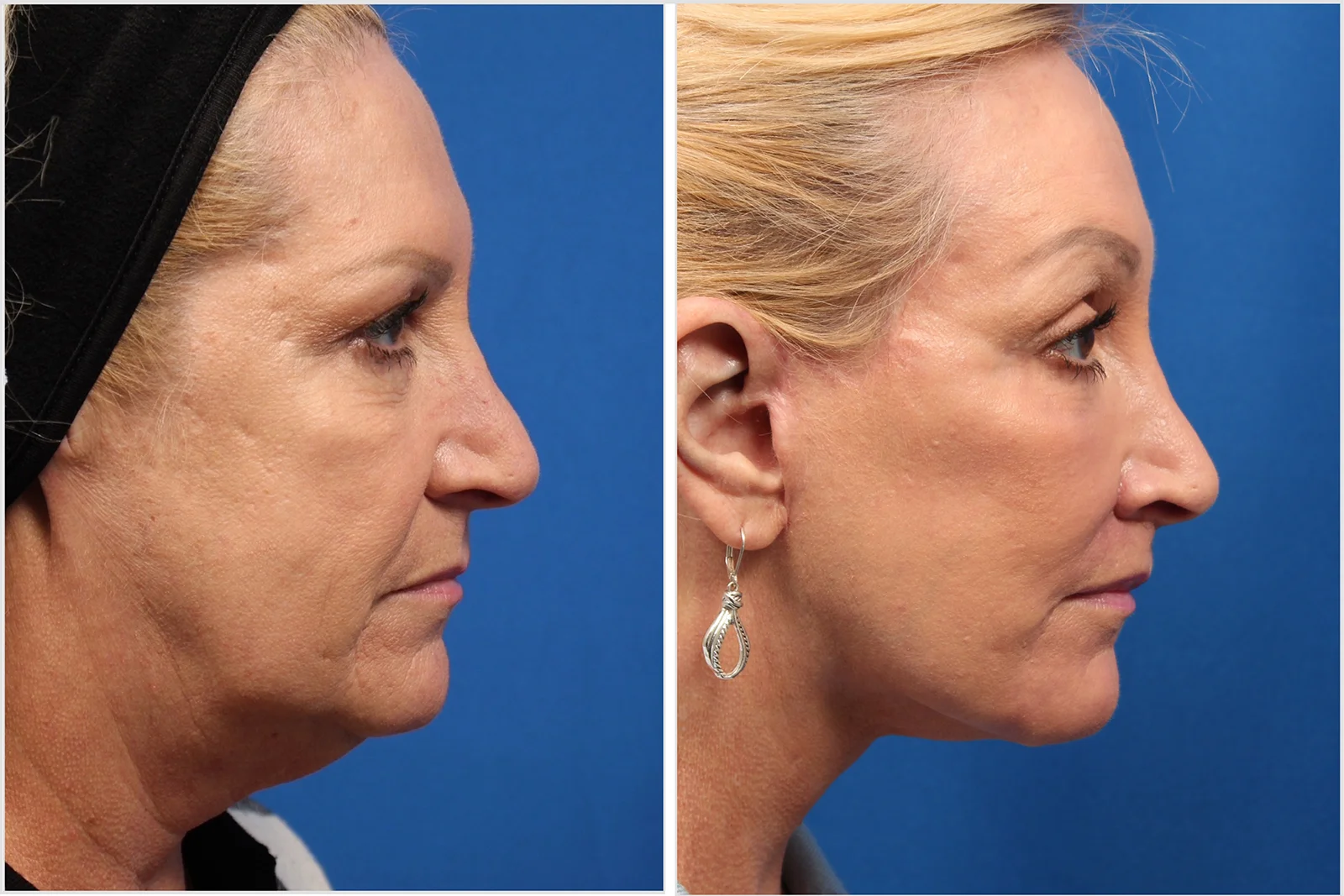 1429D3F2-9FD6-4360-9AB8-9ABE27F6CD1A