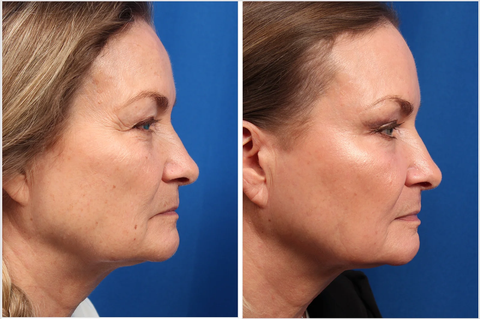 1632C541-92EF-4A81-A657-4B431458265C