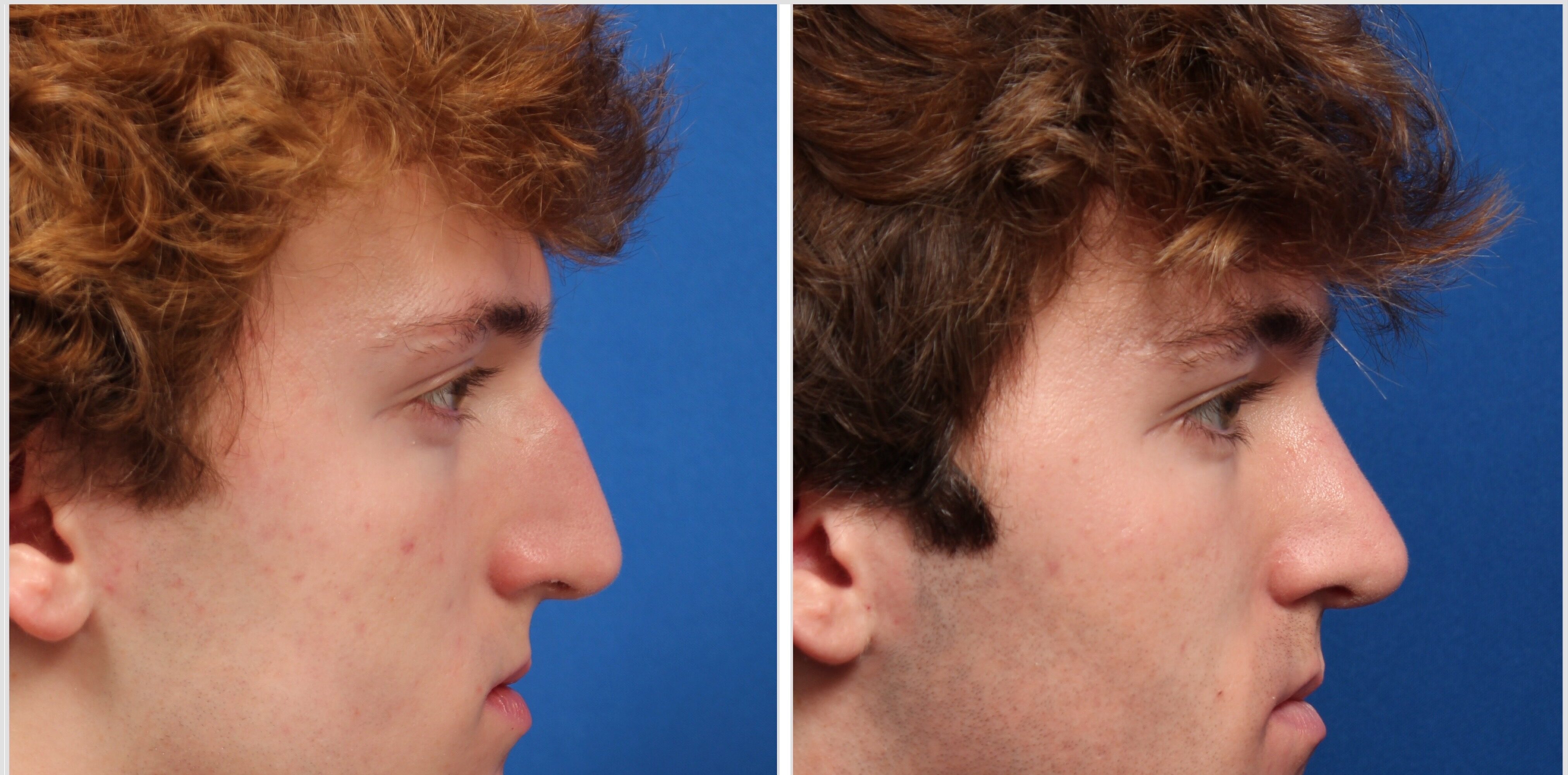 197EB313-49AE-4B69-80B1-C7067A2A1323