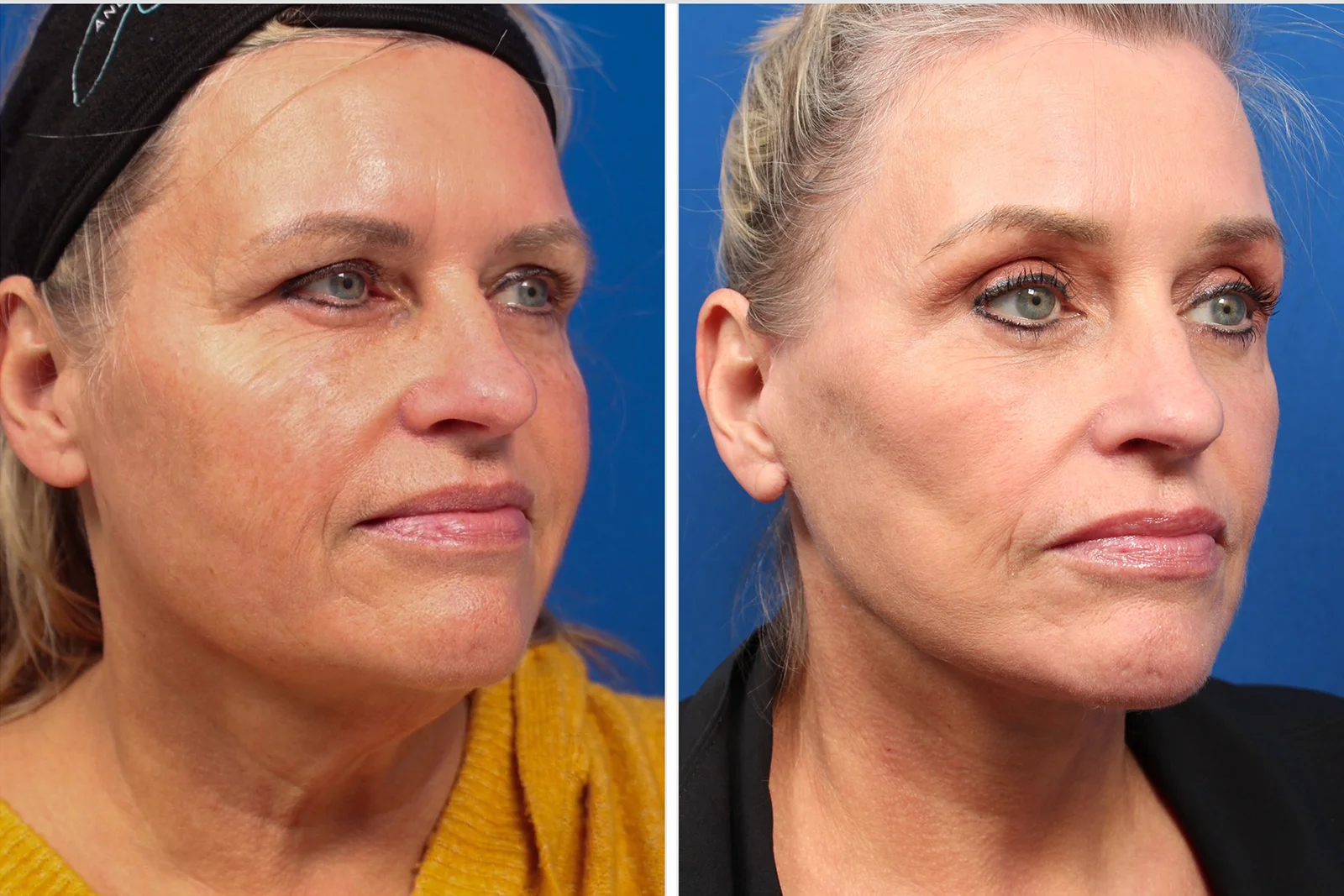 2234DF48-E3FC-4366-A8AD-33DCFEEDACF5