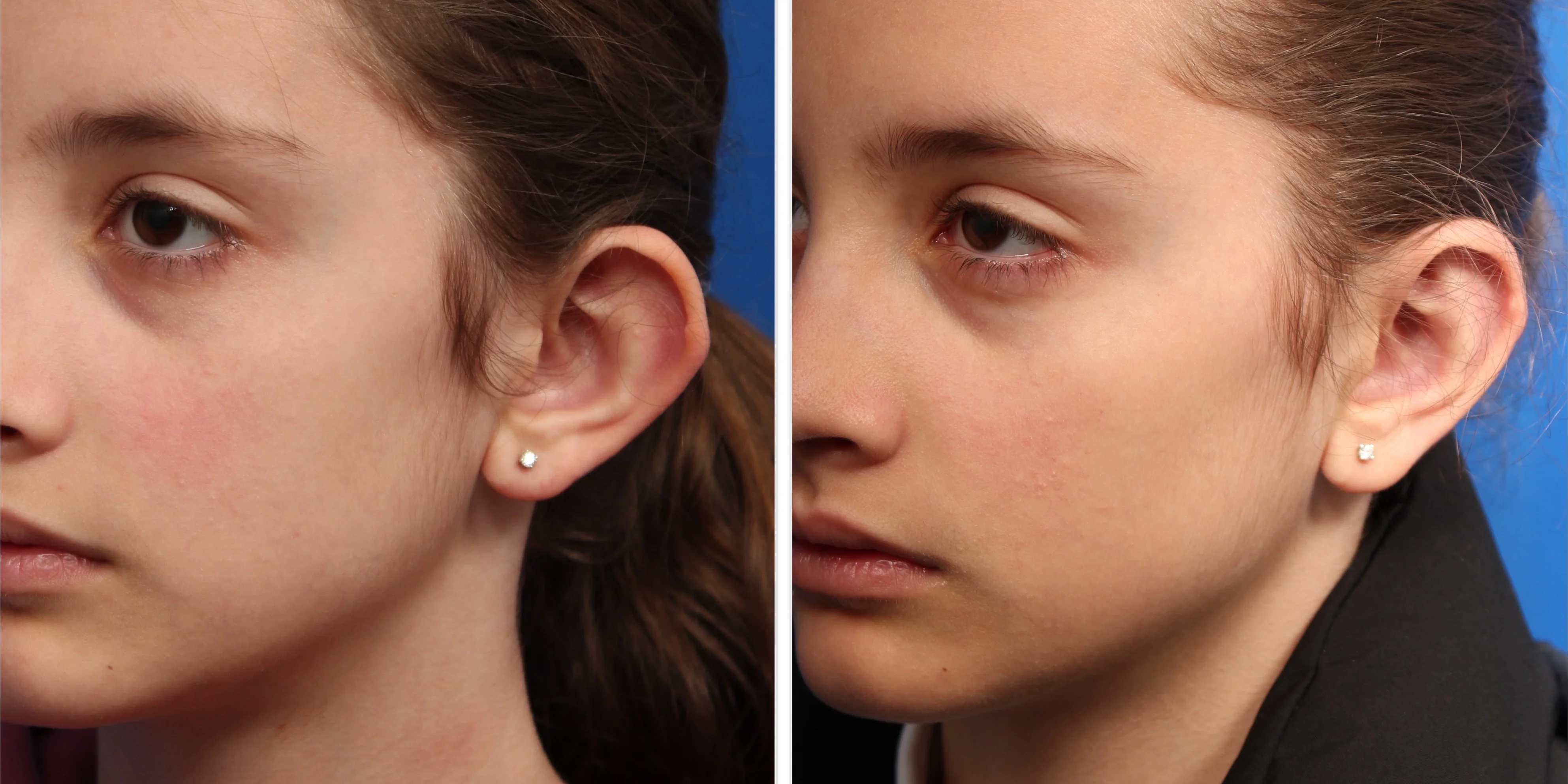 23A190F3-29B2-4DFC-B5E5-91F12E5FB6A2