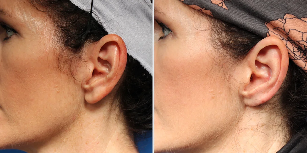 2494CBFE-25CF-4683-A21C-220A1C14B6EF