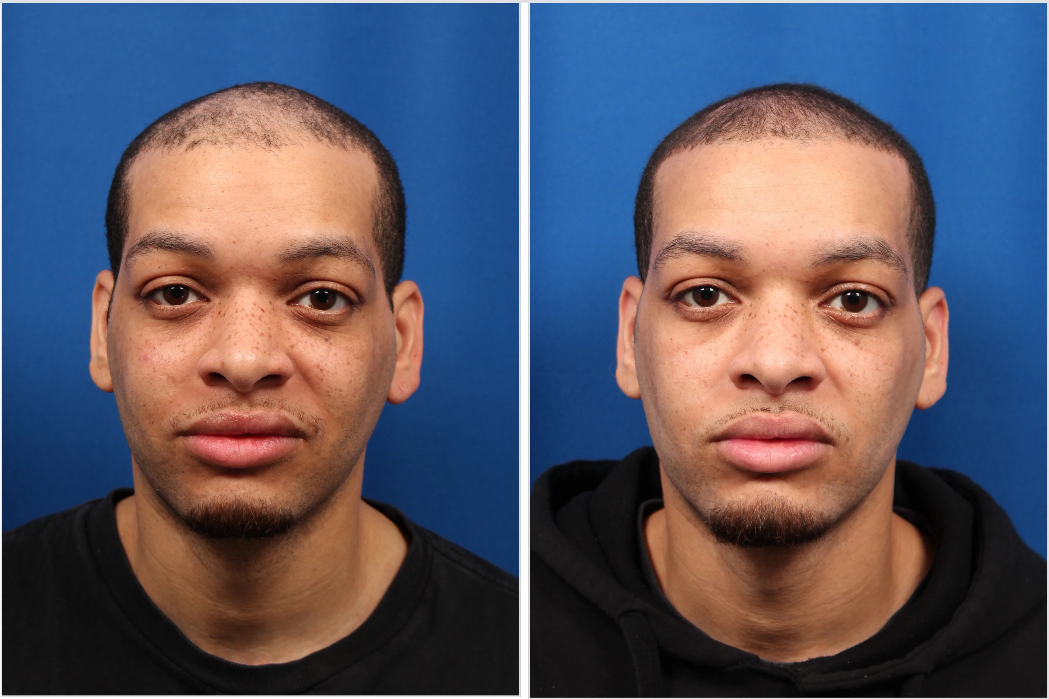 29D6EB2D-B757-4F33-8CF5-8AB0D433F344