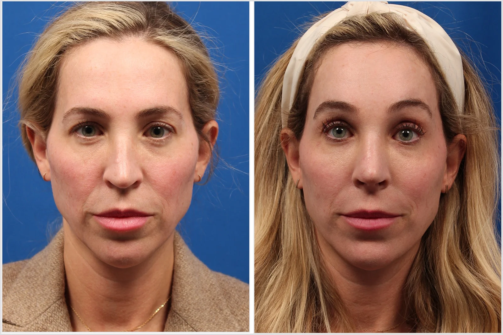 2C39BA5E-4F89-470C-83C3-75F043D54445