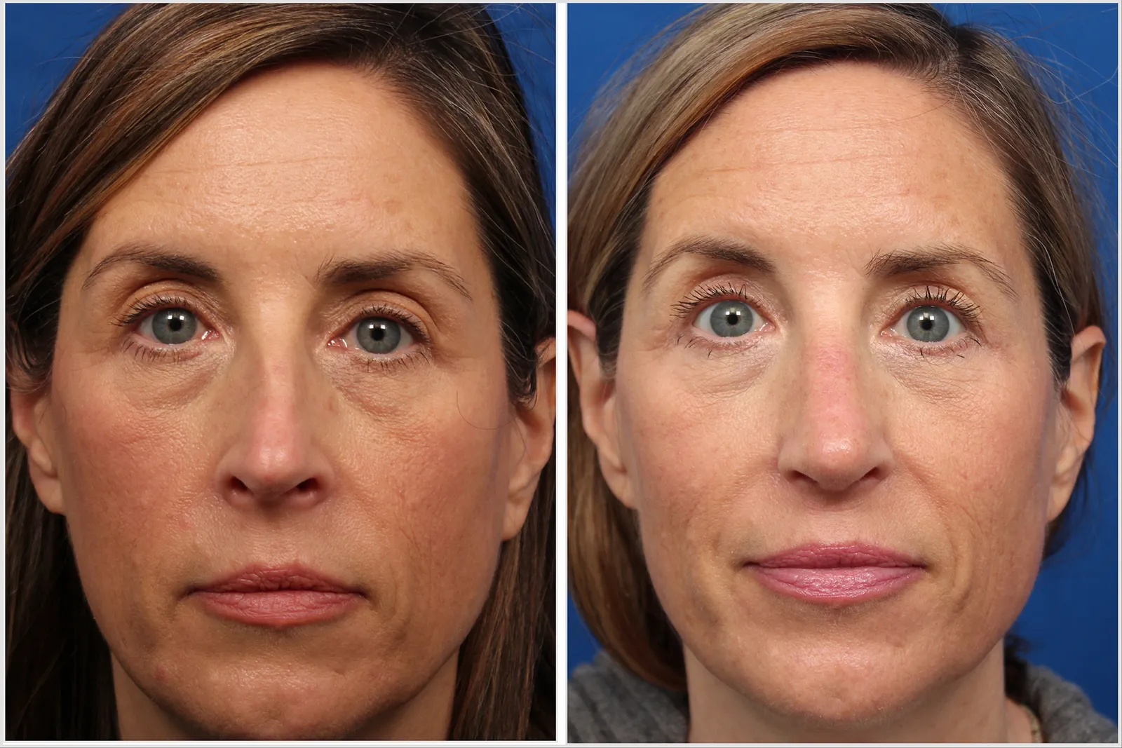 2CB90FF3-B715-4F3B-97D4-725BABB0E3E2