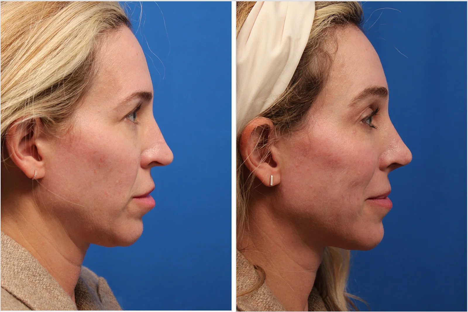 32896E77-F744-42C2-A4E8-4897C66A7504