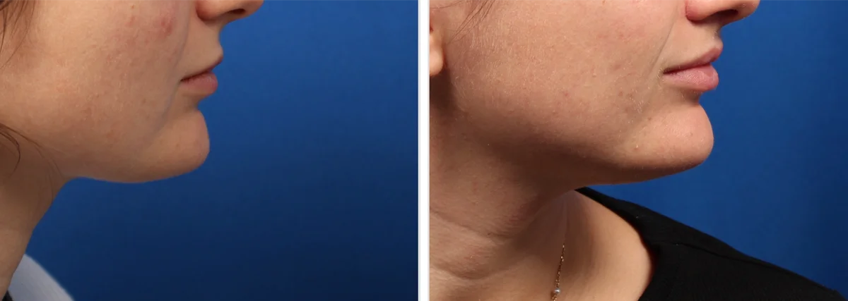 3596FF40-7765-4034-87B7-BE06B2C04B19