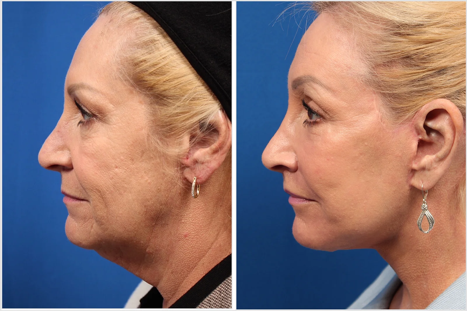 3801C253-4519-4EF4-A7B3-A68F552D3B91