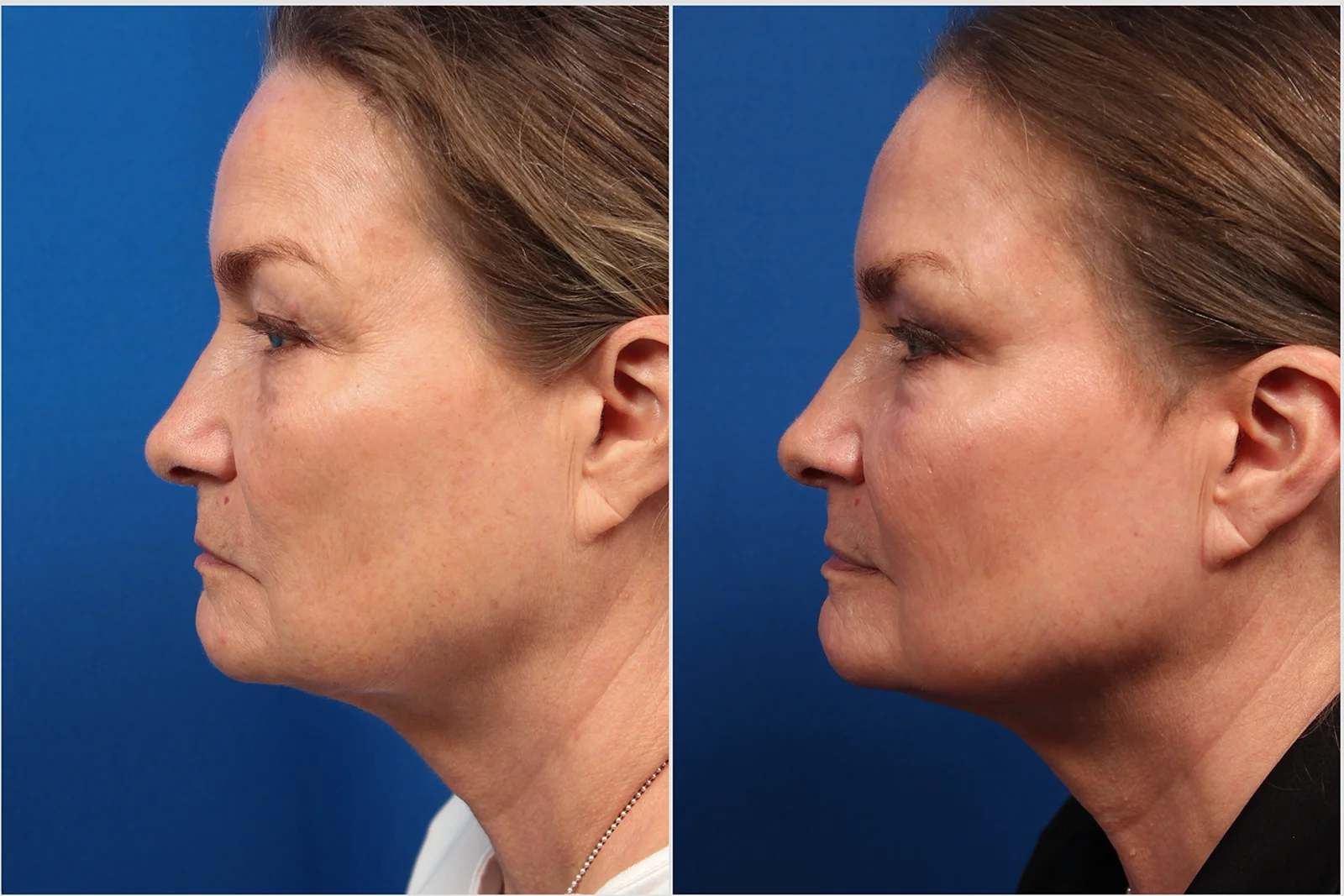 38BBD936-29A7-4C24-B1E6-824D830A8376