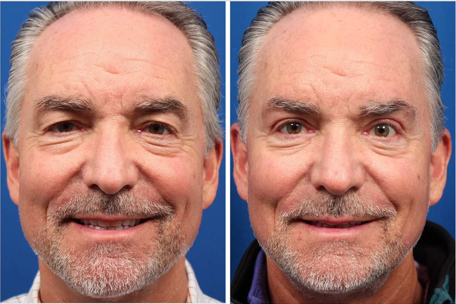 3D5133E6-4DDC-4292-8DC9-FAD268BF7D25