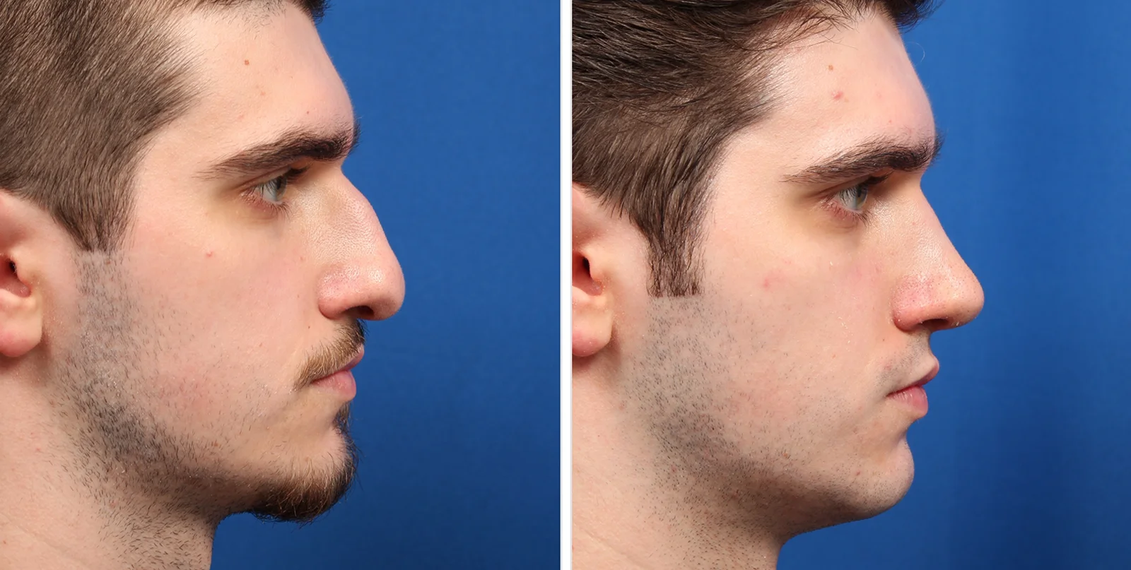 4005D050-1AD2-48AB-AAFC-AD478B74D23D