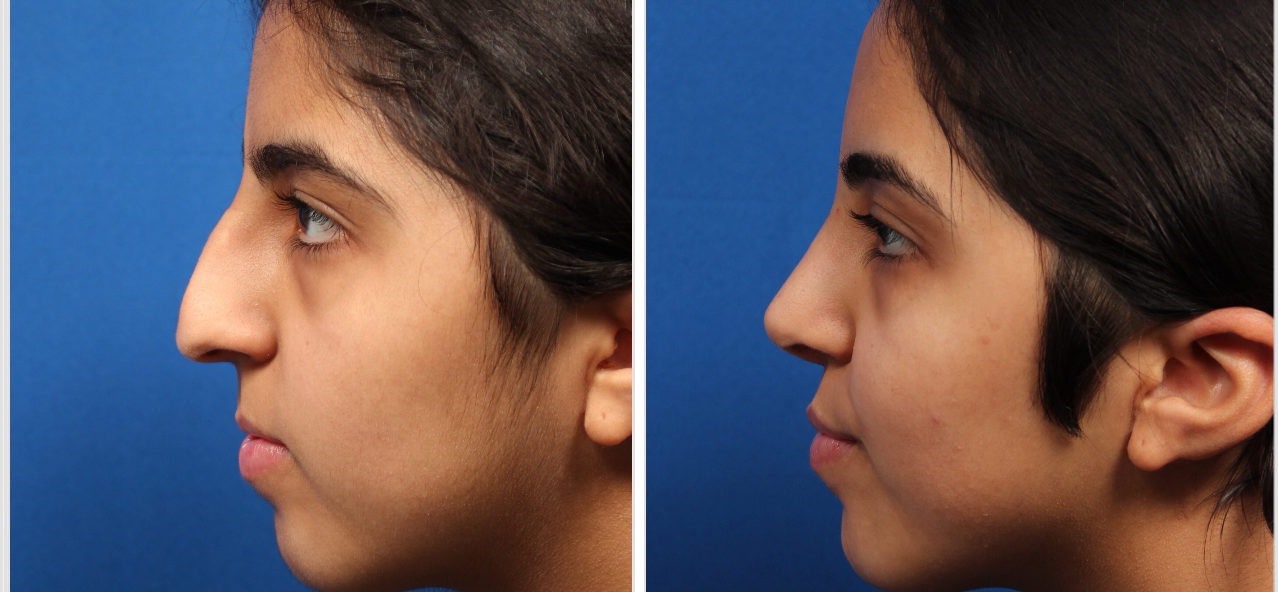 43D7B20A-E25B-4211-A62D-4DBA1691CF5D