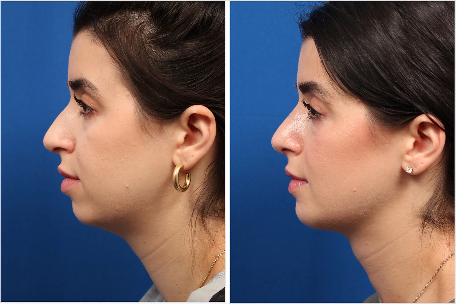 4ECC1D1F-837A-40B4-979D-21C1CDD6B162