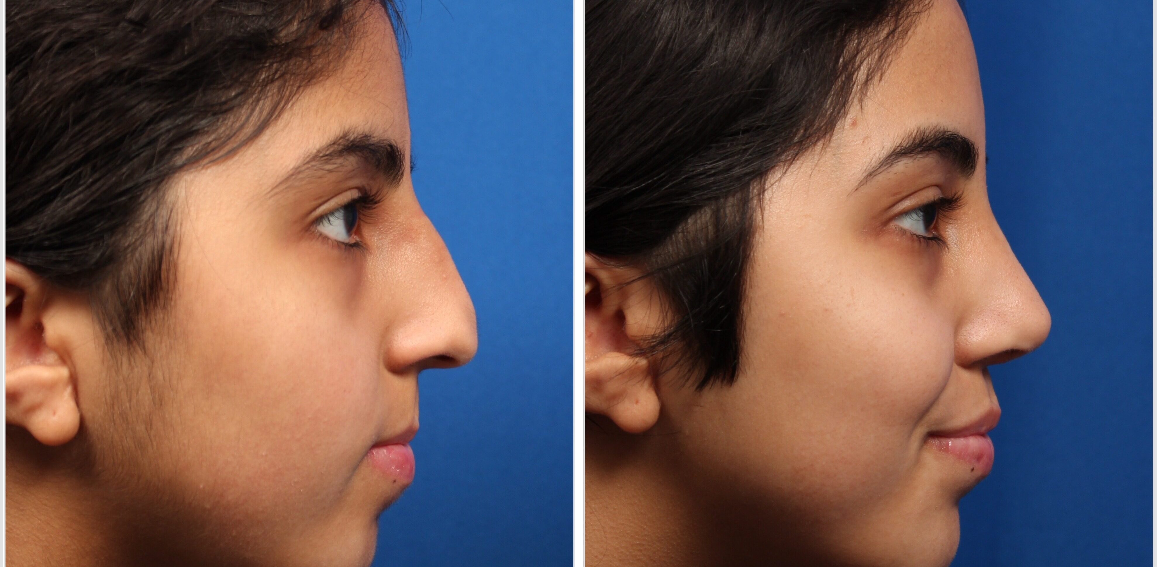 54A2EEC3-B18A-4CDF-87C8-A62890610092