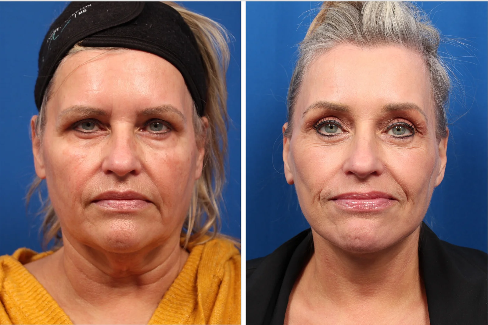 5A349938-FA83-4787-83C8-0B04E368A27E