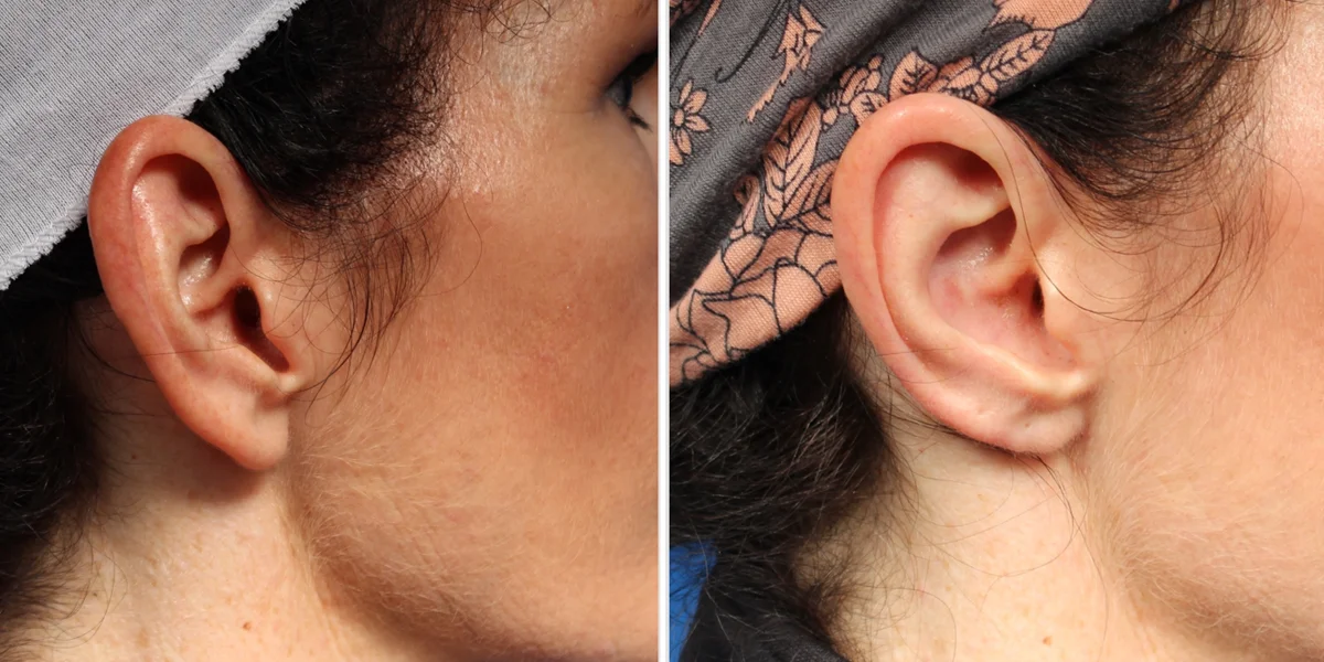 634CC21E-BDDD-4FB4-BB2D-395141E68C5F