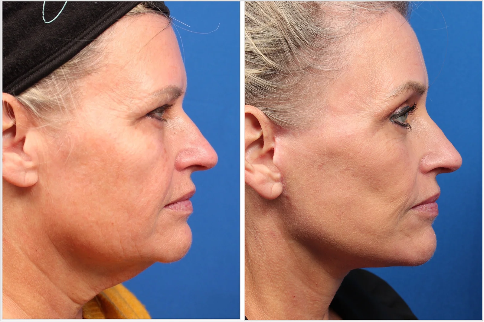 637D52F5-C8C6-42A4-BB06-4E70FBAA7CE0