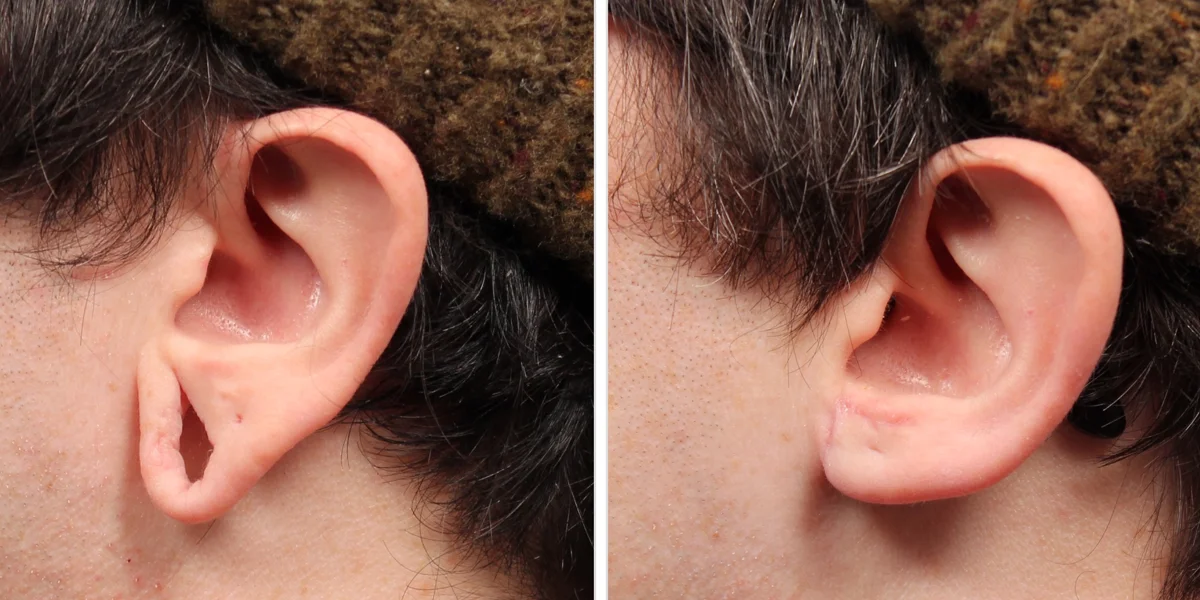 650F5DCD-0217-483A-898F-1B407CEC8CB9