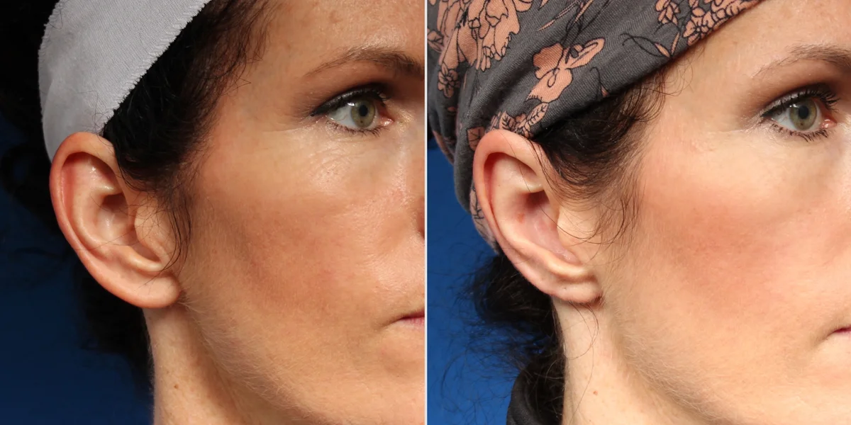 6B502766-2B1E-4F56-A451-A24BBAD8A222