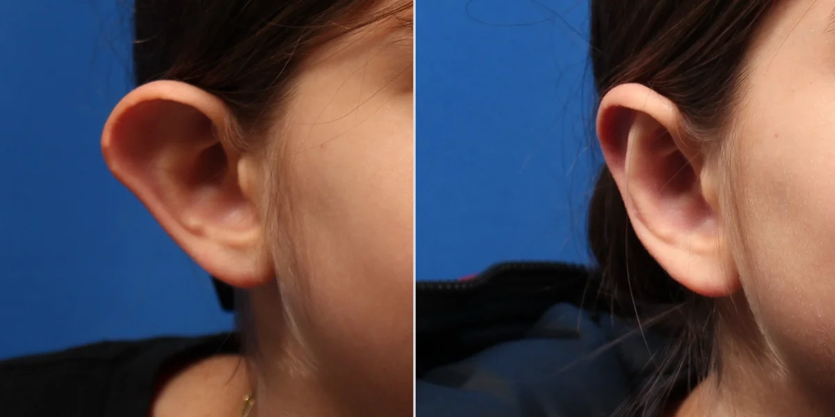 6C01732F-BDCD-44C5-8DB7-CA045E3AF822