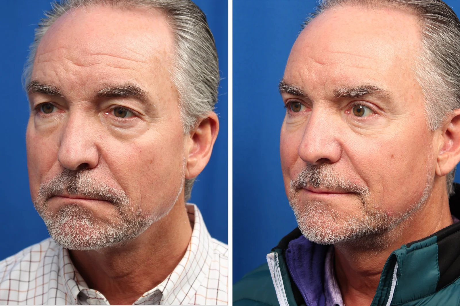 6DB8A925-76E5-4E25-B4F0-EA4825A44D01