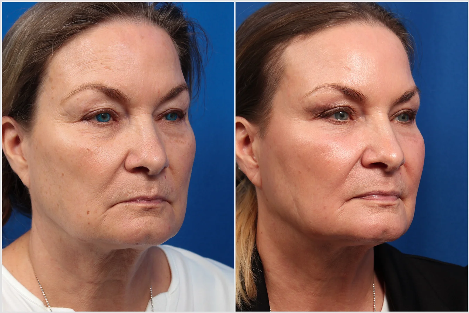 71C970E1-0305-4E65-9BC2-FFD54AC6D21D