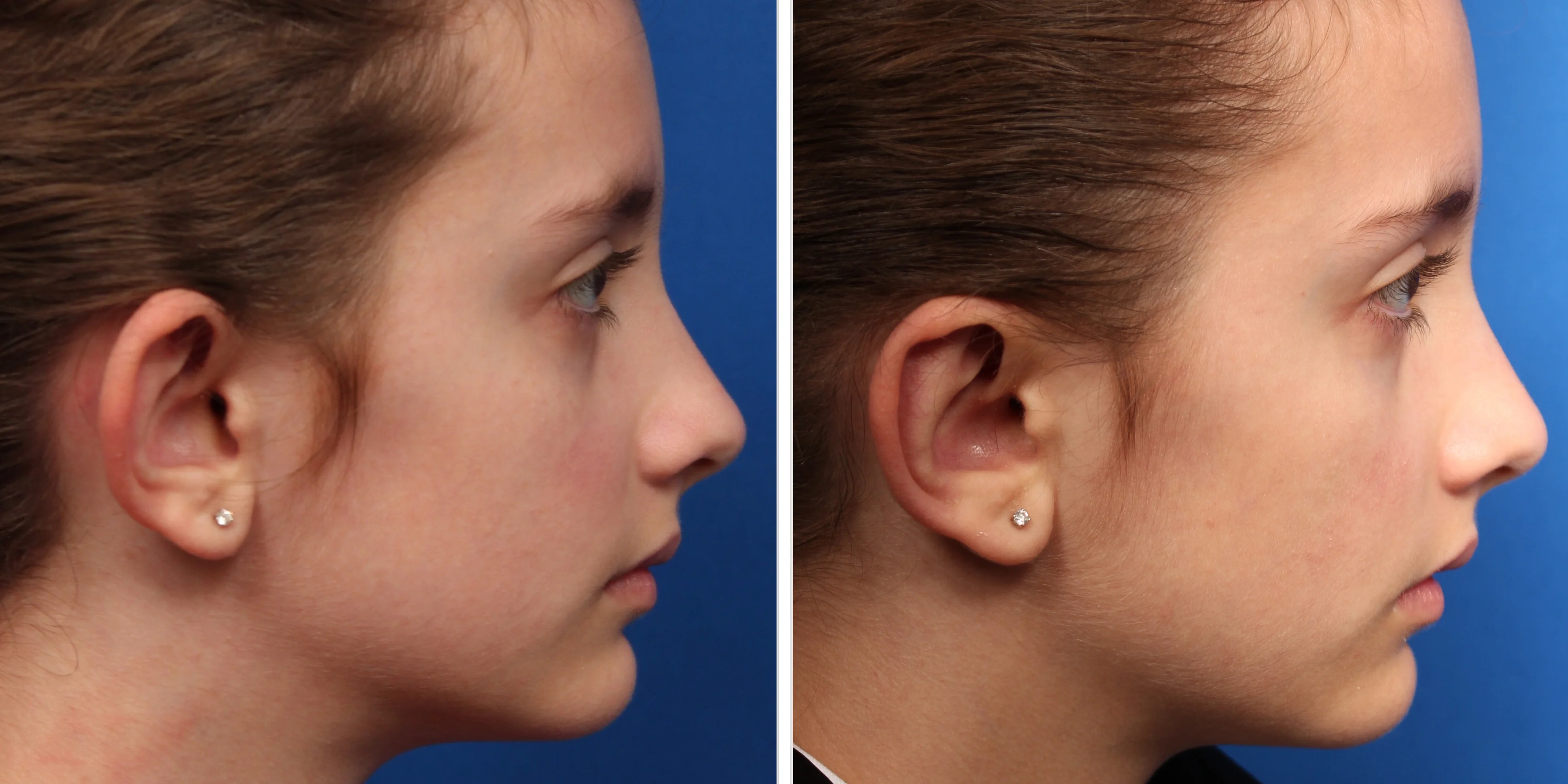 81962981-7031-4BD4-8FF1-3D3372BD547C