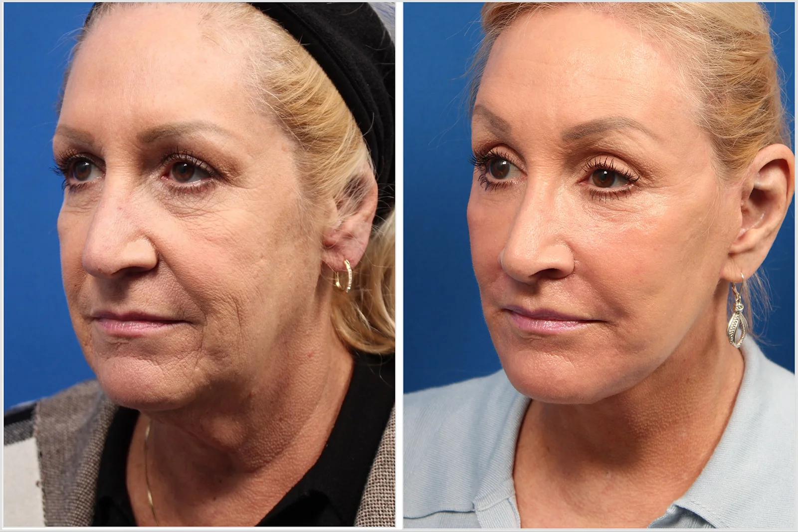 85D88254-D0C7-4DD5-B11B-89DF114262EC