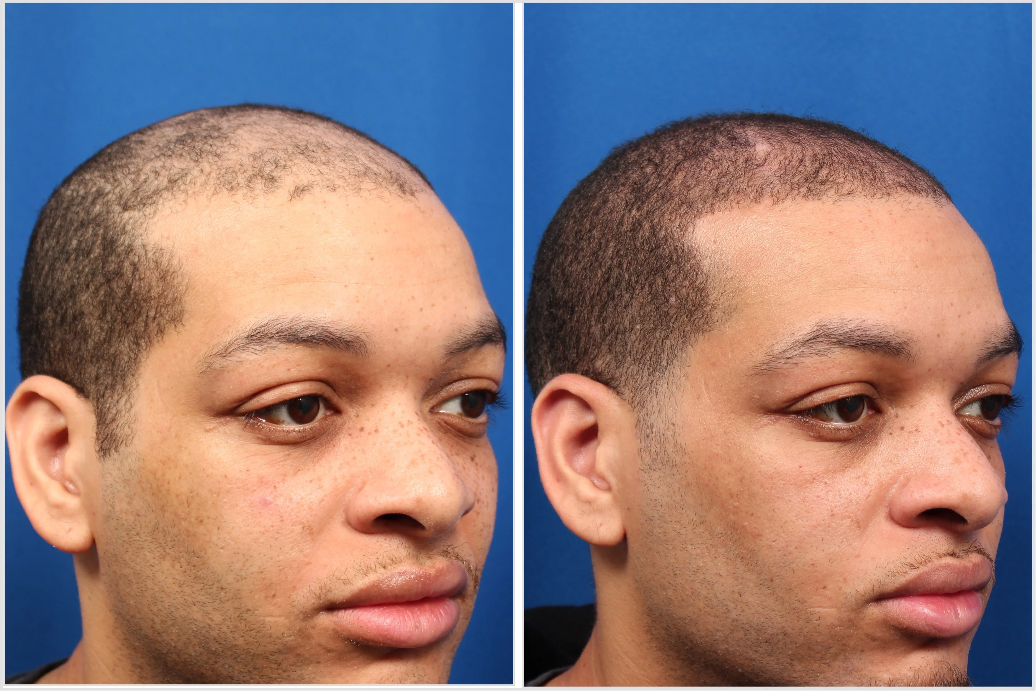 88033DE1-70D1-43FB-B8B7-09B3CFADBD6A