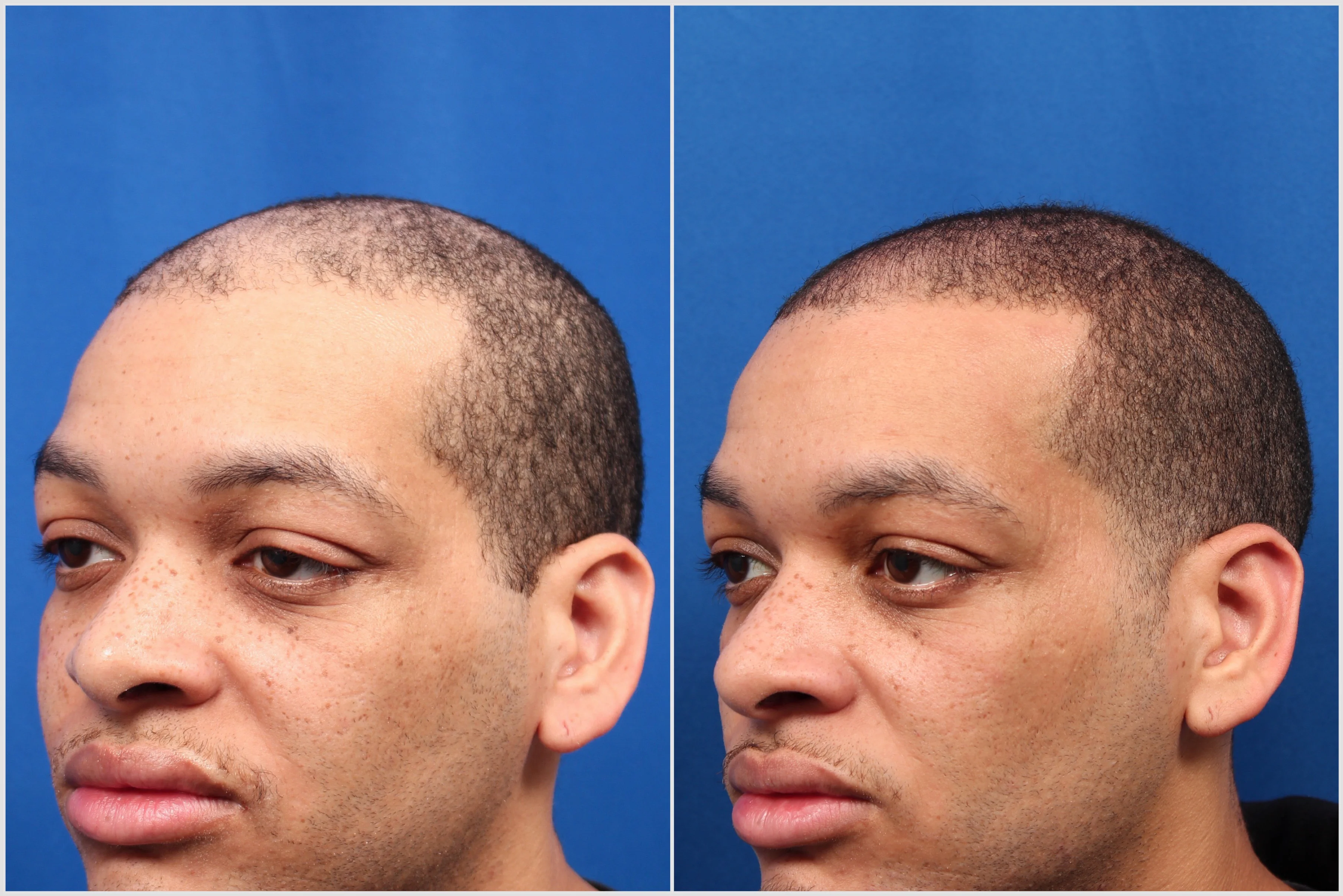 9B4BD513-B0FA-44FD-BE55-B1D26F3510F5