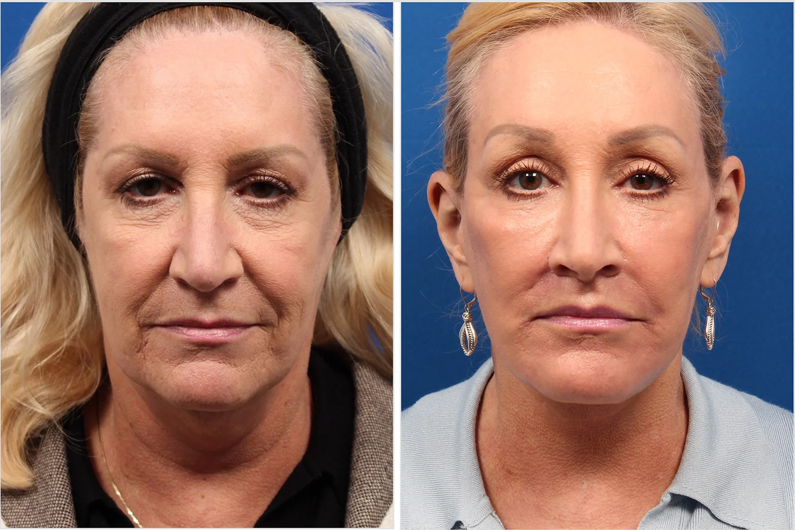 A48A3E47-8426-407B-A454-8684EDAC45ED