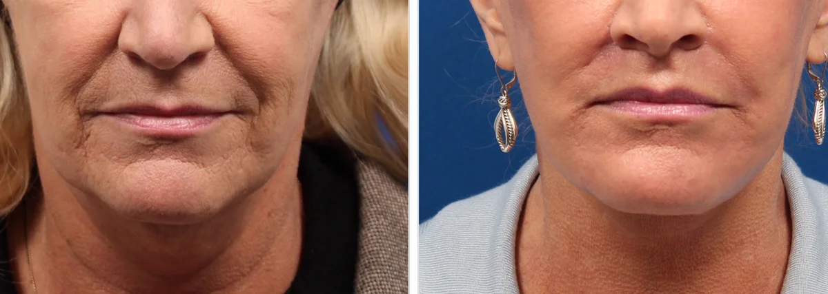 A48A3E47-8426-407B-A454-8684EDAC45ED