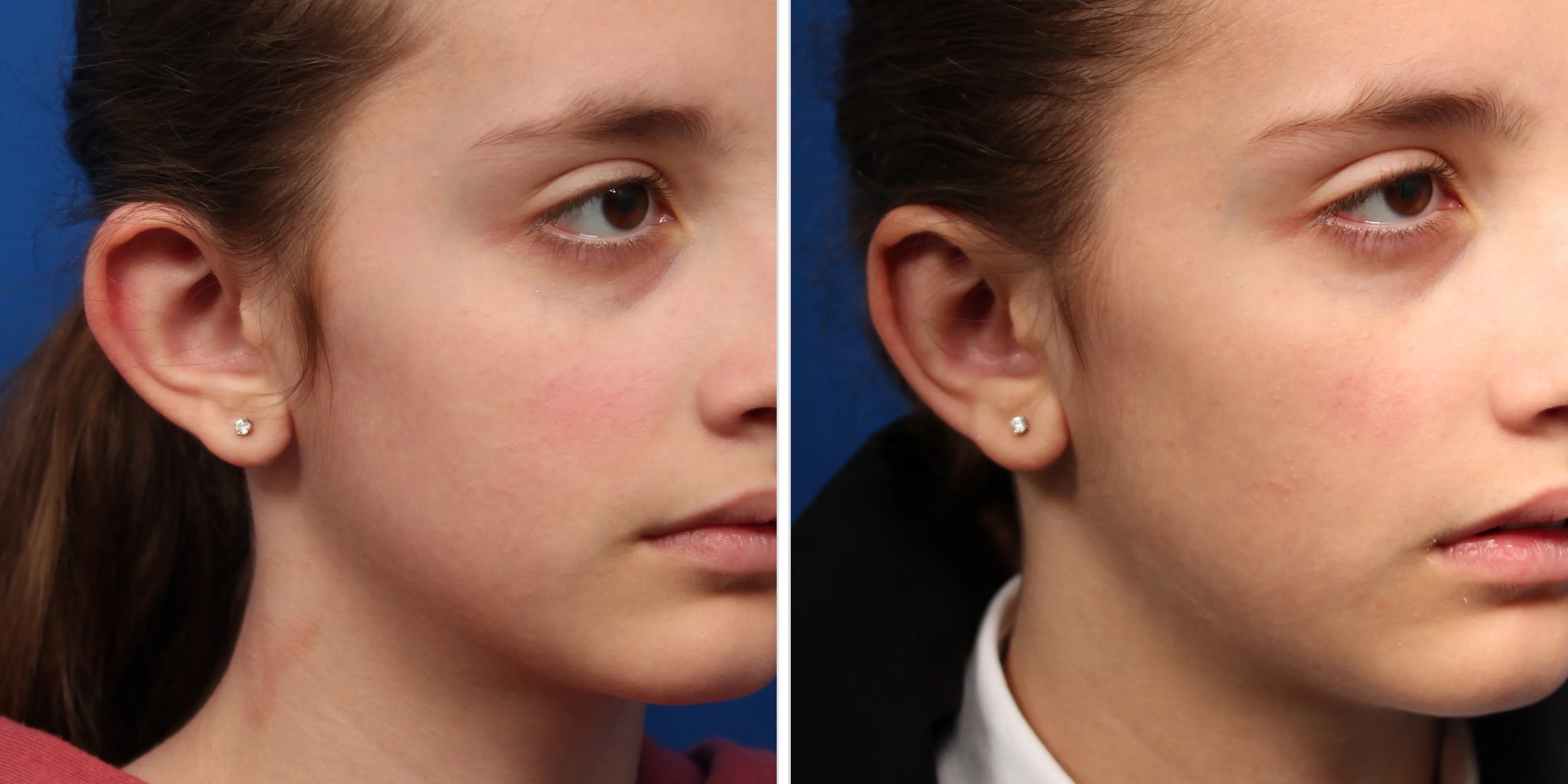 A7A3544B-CE6C-4B5B-8406-04097E08449F