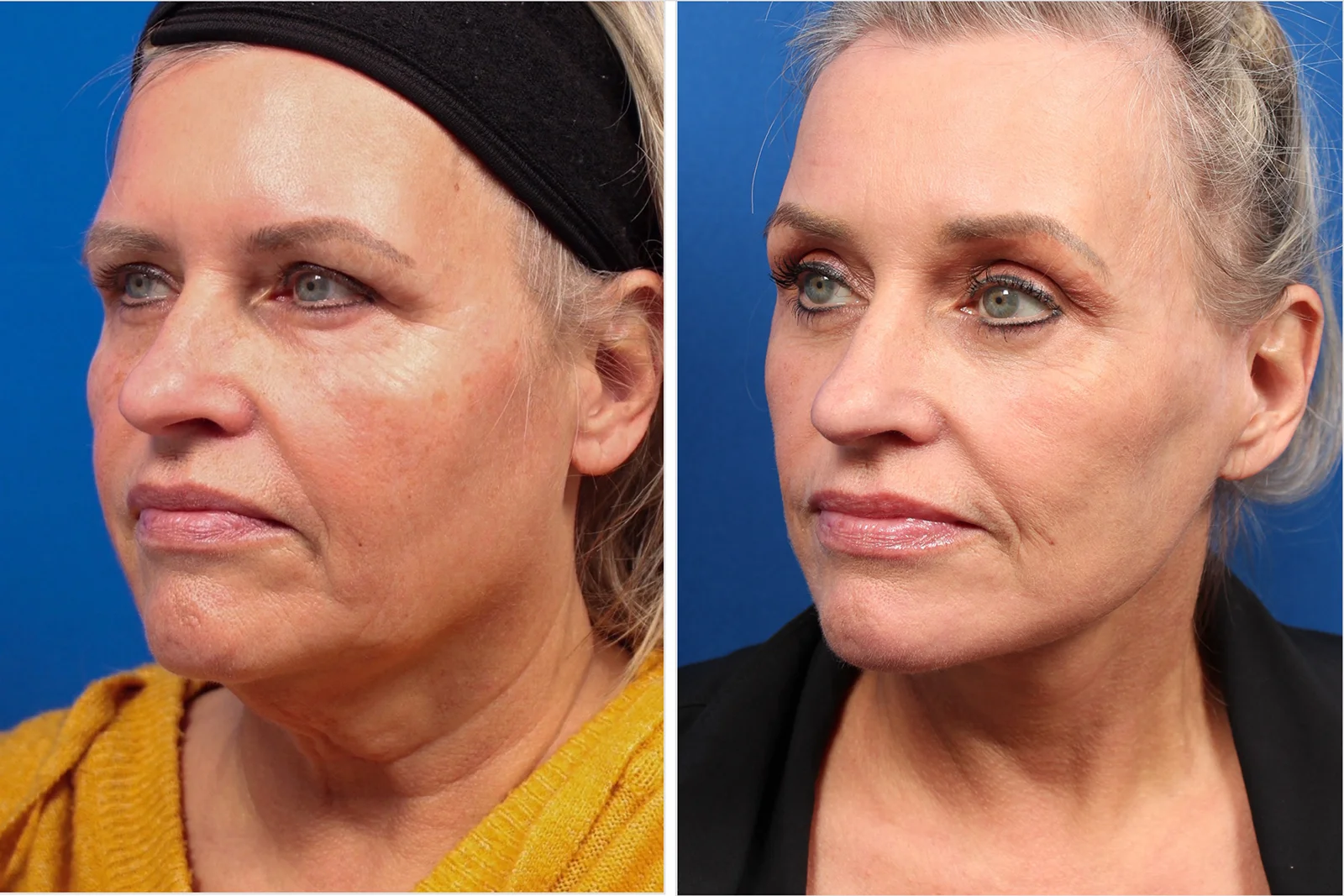 AC282EC3-33B4-48C0-BC2F-41FD936400B0