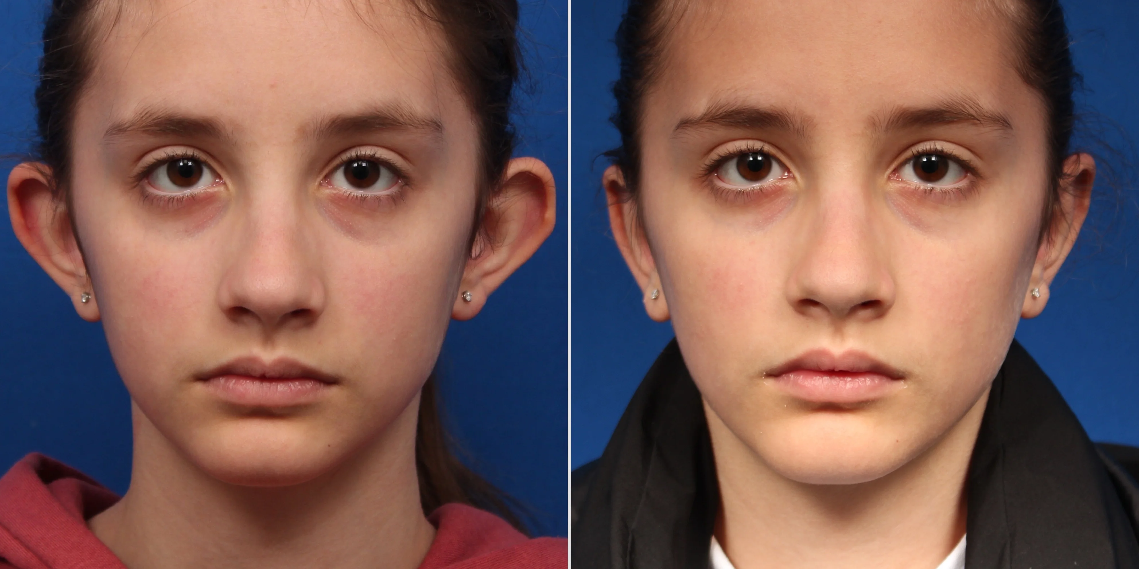 BBD816D9-D0BF-488D-86C0-F560E1AA797C