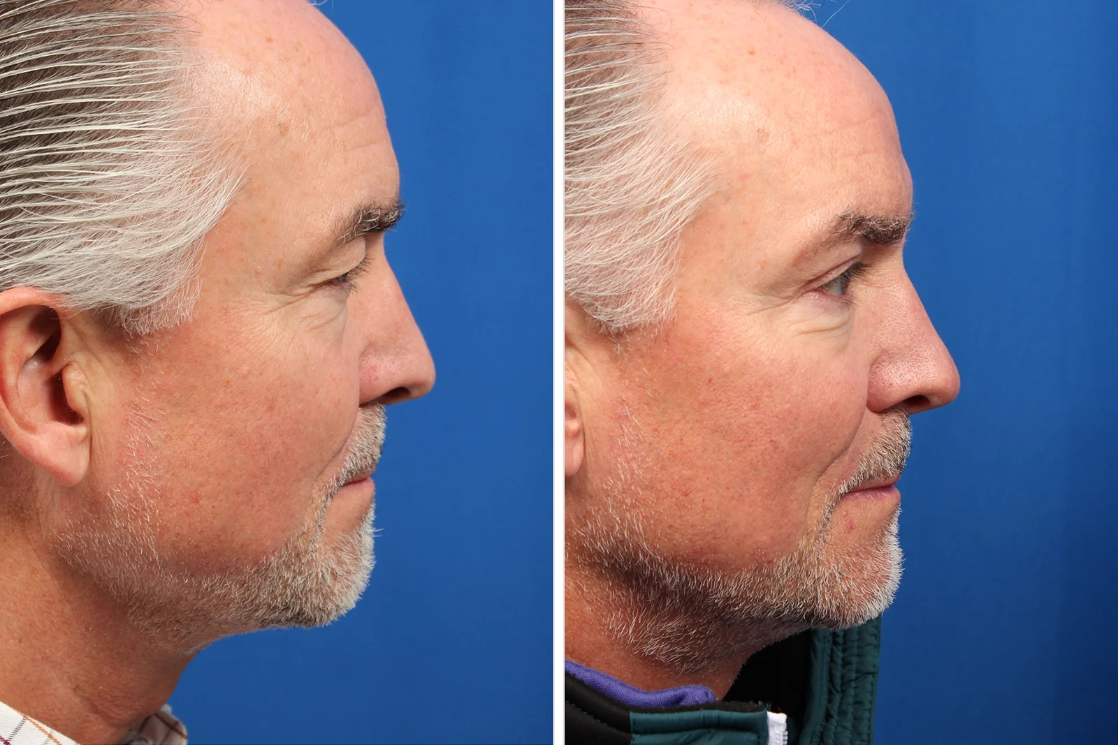 C7A70191-A36F-42BD-8CED-2B6FD5AB5117