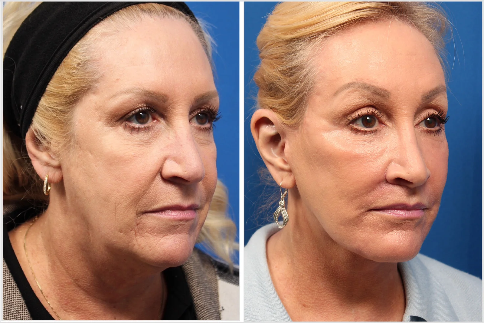 CA15717A-13BB-4579-A399-CEF29E826DEA