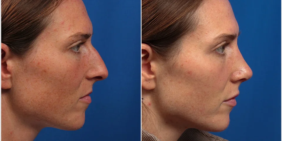 CFF82812-CD0B-4B16-8031-08DB107D2431