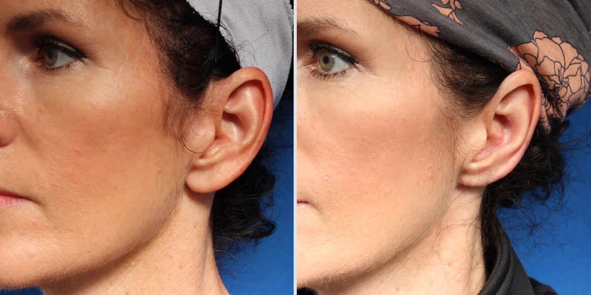 D048B2FC-6162-4EF4-930D-A52397B93E55