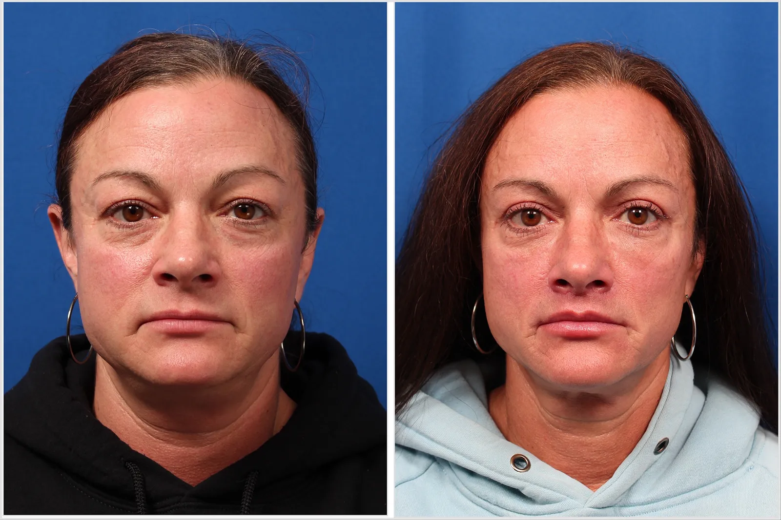 D5CE8147-530A-4BC4-86A3-75A47C2E3CB1