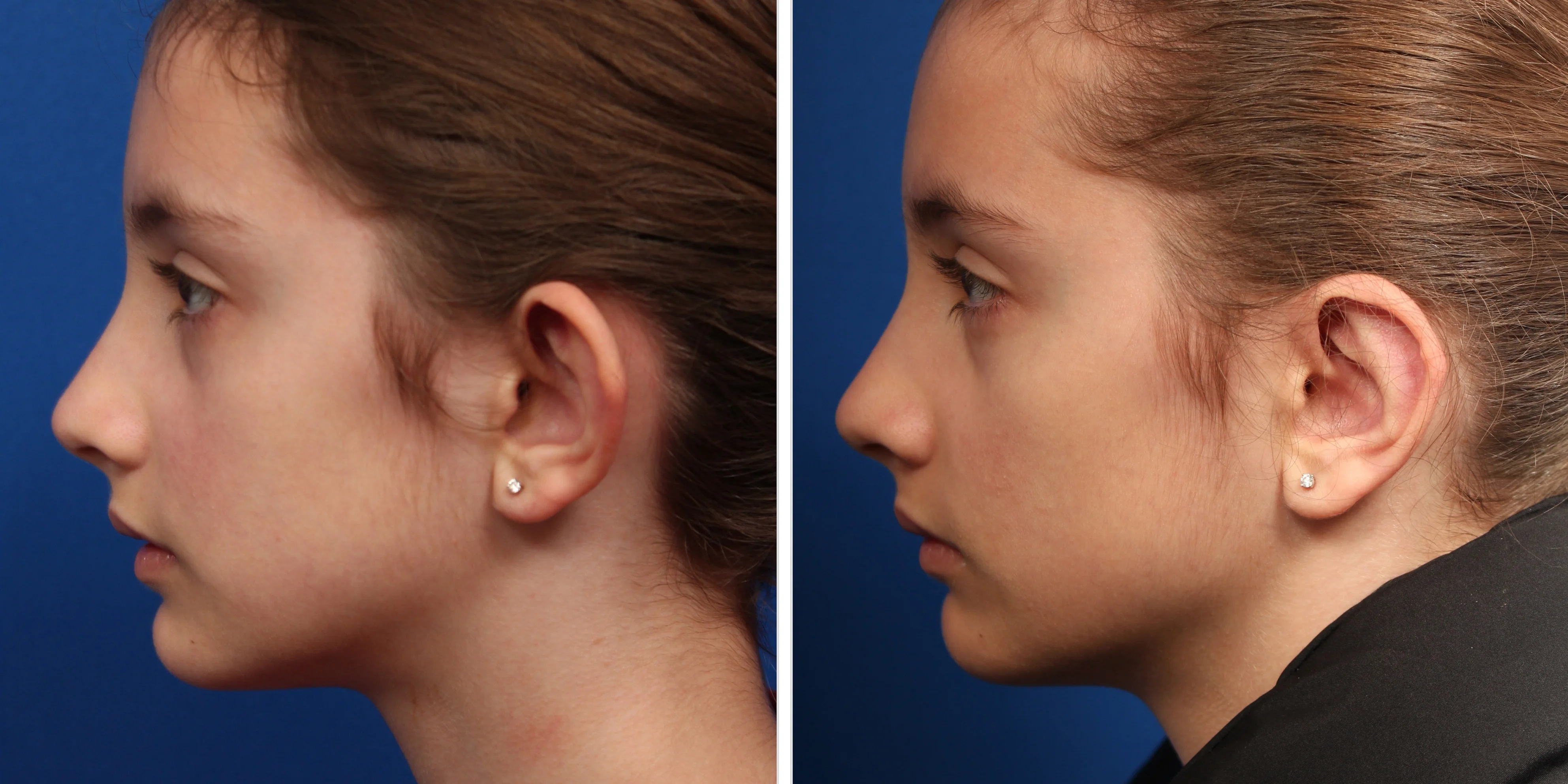 D9E232A1-8E38-483E-8943-5945576A3939