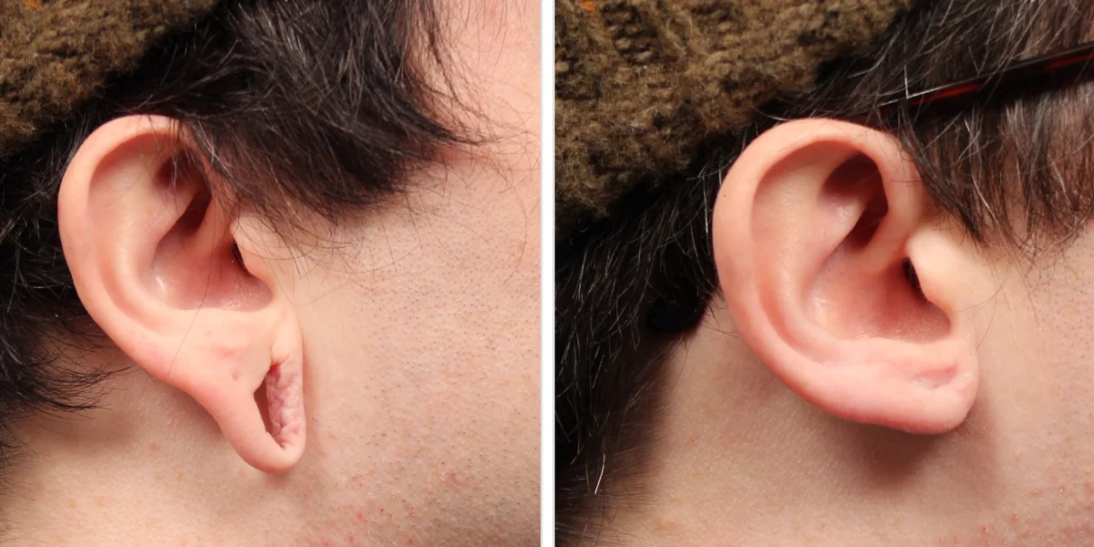 DA1EAA4C-802A-45FE-9ECF-CBFDC866759F